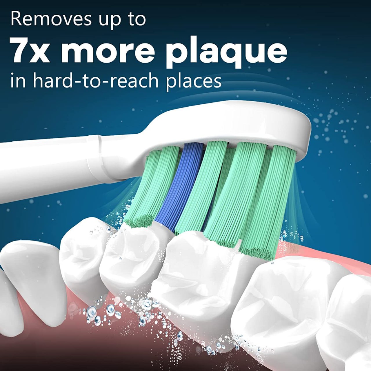 Plaque cleaning feature visual